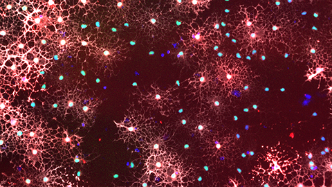 Proteomics reveals hallmarks of aging in brain stem cells
