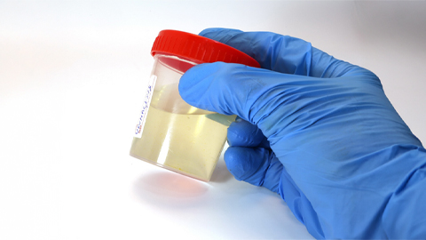 New mass spectrometry assay speeds up UTI diagnosis