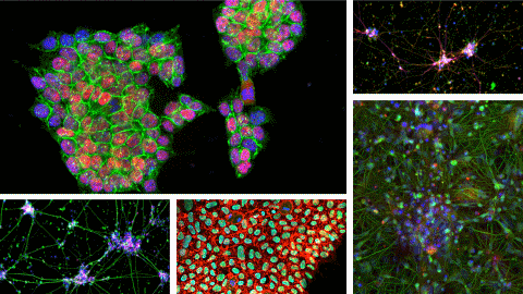 A new kind of stem cell is revolutionizing regenerative medicine